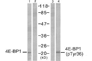 Western blot analysis of extracts from MDA-MB-435 cells, untreated or EGF-treated (200 ng/ml, 30min), using 4E-BP1 (Ab-36) antibody (Line 1 and 2) and 4E-BP1 (phospho-Thr36) antibody (Line 3 and 4). (eIF4EBP1 antibody  (pThr36))