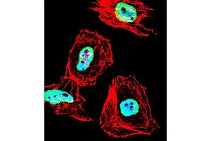 Fluorescent confocal image of Hela cell stained with HDAC1 Antibody (Center ) (ABIN1538397 and ABIN2848543). (HDAC1 antibody  (AA 402-430))