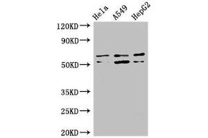 Western Blot Positive WB detected in: Hela whole cell lysate, A549 whole cell lysate, HepG2 whole cell lysate All lanes: COQ8B antibody at 3 μg/mL Secondary Goat polyclonal to rabbit IgG at 1/50000 dilution Predicted band size: 61, 56 kDa Observed band size: 61, 56 kDa (COQ8B antibody  (AA 10-137))