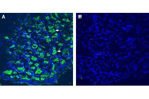 Expression of Leptin Receptor in rat dorsal root ganglion (DRG). (Leptin Receptor antibody  (Extracellular))