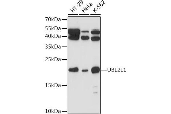 UBE2E1 Antikörper  (AA 1-193)