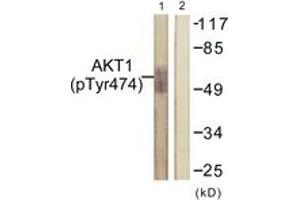 Western blot analysis of extracts from COS7 cells treated with UV 15', using Akt (Phospho-Tyr474) Antibody. (AKT1 antibody  (pTyr474))