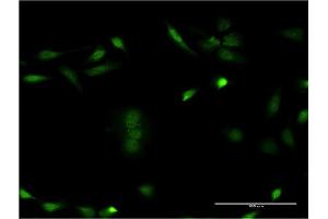 Immunofluorescence of monoclonal antibody to CSNK1E on HeLa cell. (CK1 epsilon antibody  (AA 2-100))