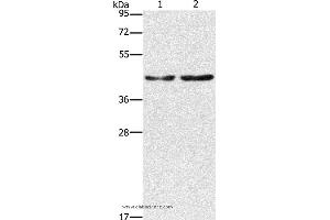Western blot analysis of Hela and 293T cell, using CBX6 Polyclonal Antibody at dilution of 1:600 (CBX6 antibody)