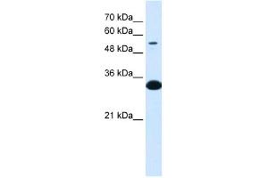 Western Blot showing A1BG antibody used at a concentration of 1-2 ug/ml to detect its target protein. (A1BG antibody  (N-Term))