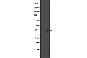 Western blot analysis of OR51M1 expression in SiHa cell line lysates ;,The lane on the left is treated with the antigen-specific peptide.