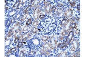ACCN3 antibody was used for immunohistochemistry at a concentration of 4-8 ug/ml to stain Epithelial cells of renal tubule (arrows) in Human Kidney. (ASIC3 antibody  (N-Term))