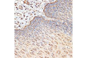 Immunohistochemistry of paraffin-embedded human esophageal using TSC2 Rabbit pAb (ABIN6128542, ABIN6149611, ABIN6149612 and ABIN6213862) at dilution of 1:100 (40x lens). (Tuberin antibody  (AA 900-1150))