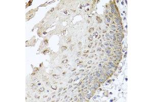 Immunohistochemistry of paraffin-embedded human esophagus using IRS2 antibody at dilution of 1:100 (x40 lens). (IRS2 antibody)