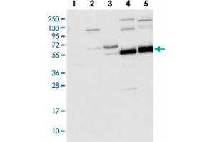 Western blot analysis of Lane 1: RT-4, Lane 2: U-251 MG, Lane 3: Human Plasma, Lane 4: Liver, Lane 5: Tonsil with TRIM7 polyclonal antibody  at 1:250-1:500 dilution. (TRIM7 antibody)