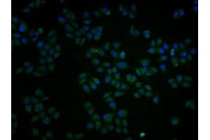 Immunofluorescence staining of Hela cells with ABIN7162877 at 1:100, counter-stained with DAPI. (PCNT antibody  (AA 250-600))