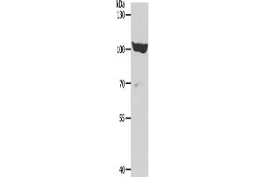 Gel: 8 % SDS-PAGE, Lysate: 40 μg, Lane: 293T cells, Primary antibody: ABIN7189653(ADAMTS15 Antibody) at dilution 1/600, Secondary antibody: Goat anti rabbit IgG at 1/8000 dilution, Exposure time: 30 minutes (ADAMTS15 antibody)