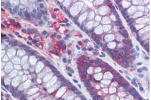 Human Colon: Formalin-Fixed, Paraffin-Embedded (FFPE) (G3BP1 antibody  (AA 214-303))