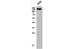Western Blotting (WB) image for anti-Insulin Receptor Substrate 1 (IRS1) (pSer636) antibody (ABIN7181771)