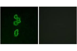 Immunofluorescence analysis of MCF7 cells, using FZD6 Antibody. (FZD6 antibody  (AA 116-165))
