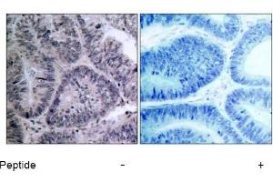 Image no. 1 for anti-conserved Helix-Loop-Helix Ubiquitous Kinase (CHUK) (Thr23) antibody (ABIN197306) (IKK alpha antibody  (Thr23))
