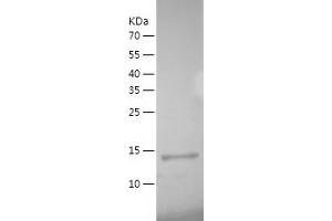 Western Blotting (WB) image for Interleukin 19 (IL19) (AA 25-176) protein (His tag) (ABIN7287840) (IL-19 Protein (AA 25-176) (His tag))
