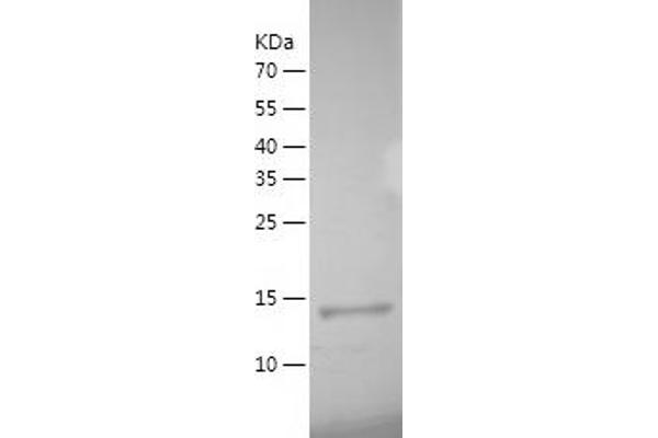 IL-19 Protein (AA 25-176) (His tag)
