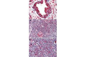 Immunohistochemical staining of formalin-fixed, paraffin-embedded human prostate (A), human thymus (B) and human spleen (C) tissue after heat-induced antigen retrieval. (WNT5B antibody  (Internal Region))