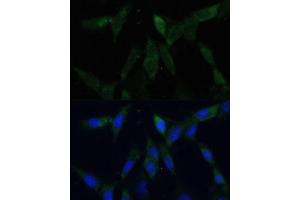 Immunofluorescence analysis of NIH-3T3 cells using ZWINT Polyclonal Antibody (ABIN6128944, ABIN6150552, ABIN6150554 and ABIN6221938) at dilution of 1:100 (40x lens).