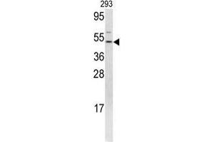 Western blot analysis of FLI1 antibody (N-term) in 293 cell line lysates (35 µg/lane). (FLI1 antibody  (N-Term))
