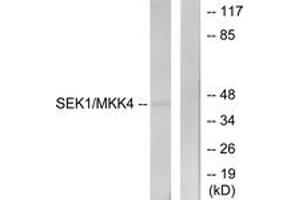 Western blot analysis of extracts from NIH-3T3 cells, using SEK1/MKK4 (Ab-80) Antibody. (MAP2K4 antibody  (AA 46-95))
