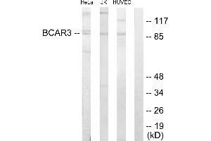 Immunohistochemistry analysis of paraffin-embedded human colon carcinoma tissue using BCAR3 antibody. (BCAR3 antibody  (C-Term))