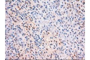 Image no. 8 for anti-Myc Proto-Oncogene protein (MYC) antibody (ABIN1497013) (c-MYC antibody)