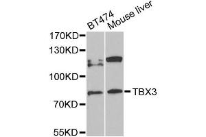 Western blot analysis of extracts of various cell lines, using TBX3 antibody (ABIN5972282) at 1/1000 dilution. (TBX3 antibody)
