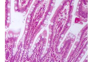 Anti-CTGF antibody IHC of human small intestine.
