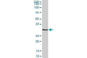 SULT1A3 MaxPab polyclonal antibody. (SULT1A3 antibody  (AA 1-295))