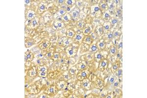 Immunohistochemistry of paraffin-embedded mouse liver using FASN Antibody (ABIN5970172) at dilution of 1/100 (40x lens). (Fatty Acid Synthase antibody)