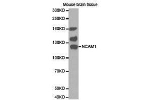 Western Blotting (WB) image for anti-Neural Cell Adhesion Molecule 1 (NCAM1) antibody (ABIN1873832) (CD56 antibody)