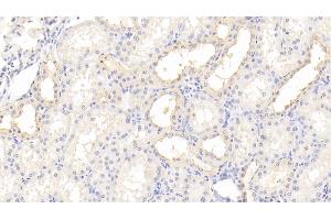Detection of TIMP3 in Human Kidney Tissue using Polyclonal Antibody to Tissue Inhibitors Of Metalloproteinase 3 (TIMP3) (TIMP3 antibody  (AA 26-211))