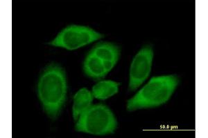 Immunofluorescence of purified MaxPab antibody to CARS on HeLa cell.