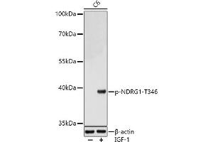 Western Blotting (WB) image for anti-N-Myc Downstream Regulated 1 (NDRG1) (pThr346) antibody (ABIN7268785)