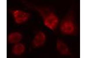 ABIN6274517 staining Hela cells by IF/ICC. (ARNT2 antibody  (N-Term))