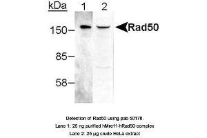 Image no. 1 for anti-RAD50 Homolog (S. Cerevisiae) (RAD50) antibody (ABIN363487) (RAD50 antibody)