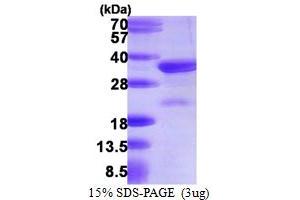 SDS-PAGE (SDS) image for Charged Multivesicular Body Protein 3 (CHMP3) (AA 1-222) protein (His tag) (ABIN667482) (CHMP3 Protein (AA 1-222) (His tag))