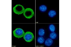 Immunofluorescence staining of fixed RAW264. (Recombinant CCRL2 antibody  (AA 1-24))