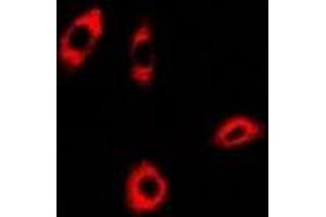 Immunofluorescent analysis of PHACS staining in A549 cells. (PHACS antibody)