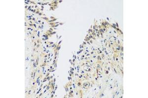 Immunohistochemistry of paraffin-embedded human lung using UPF2 antibody. (RENT2/UPF2 antibody  (AA 1153-1272))