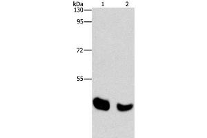 Western Blot analysis of Human normal liver and Mouse pancreas tissue using BAAT Polyclonal Antibody at dilution of 1:650 (BAAT antibody)