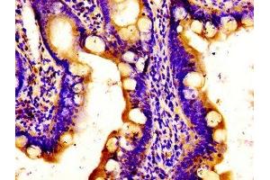Immunohistochemistry of paraffin-embedded human small intestine tissue using ABIN7150152 at dilution of 1:100 (APOBEC3D antibody  (AA 250-371))