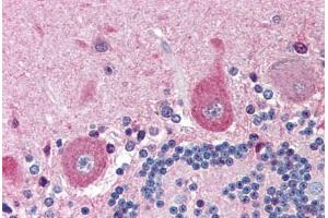 Human Brain, Cerebellum (formalin-fixed, paraffin-embedded) stained with NGFR antibody ABIN214454 at 5 ug/ml followed by biotinylated goat anti-rabbit IgG secondary antibody ABIN481713, alkaline phosphatase-streptavidin and chromogen. (NGFR antibody)