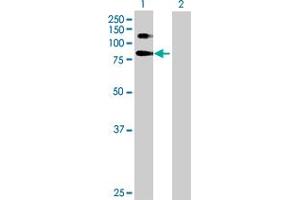 Western Blot analysis of SELP expression in transfected 293T cell line by SELP MaxPab polyclonal antibody. (P-Selectin antibody  (AA 1-829))