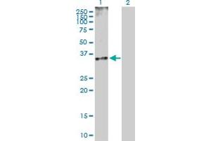 Western Blot analysis of CDK5 expression in transfected 293T cell line by CDK5 MaxPab polyclonal antibody. (CDK5 antibody  (AA 1-292))