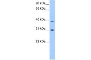 Western Blotting (WB) image for anti-Eukaryotic Translation Initiation Factor 3 Subunit H (EIF3H) antibody (ABIN2463339) (EIF3H antibody)
