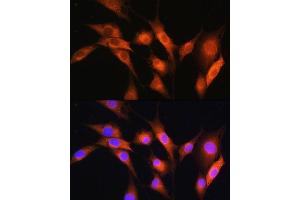 Immunofluorescence analysis of NIH/3T3 cells using  Rabbit pAb (ABIN7265658) at dilution of 1:100. (ARCN1 antibody  (AA 212-511))
