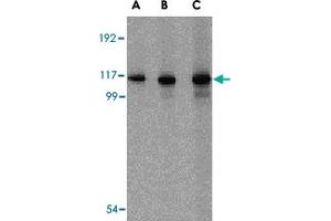 Western blot analysis of IFIH1 in Daudi cell lysate with IFIH1 polyclonal antibody  at (A) 1, (B) 2 and (C) 4 ug/mL . (IFIH1 antibody  (C-Term))